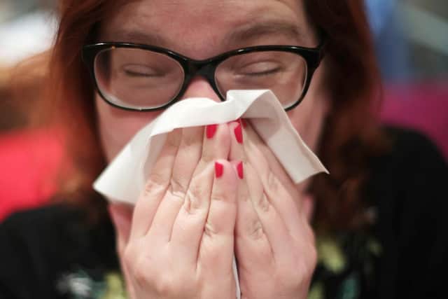 The Scottish Government said it is well-prepared to deal with a potential outbreak.