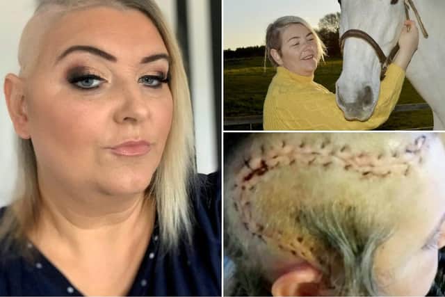 Kelly Ann Alexander, 43, says horse Aliyana was the reason she felt compelled to go to the hospital to have tests PA